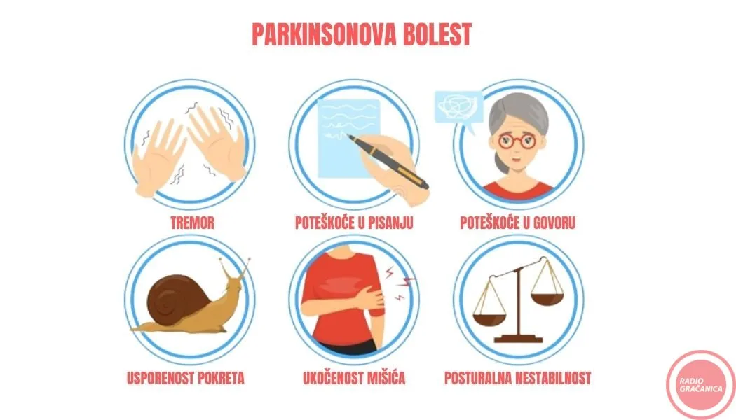 Parkinsonova bolest – Ljudi blistavog uma zarobljeni u vlastitom tijelu –