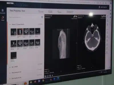 ZZO TK predstavio portal e-Pacijent